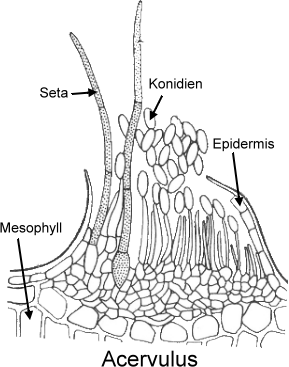 Acervulus